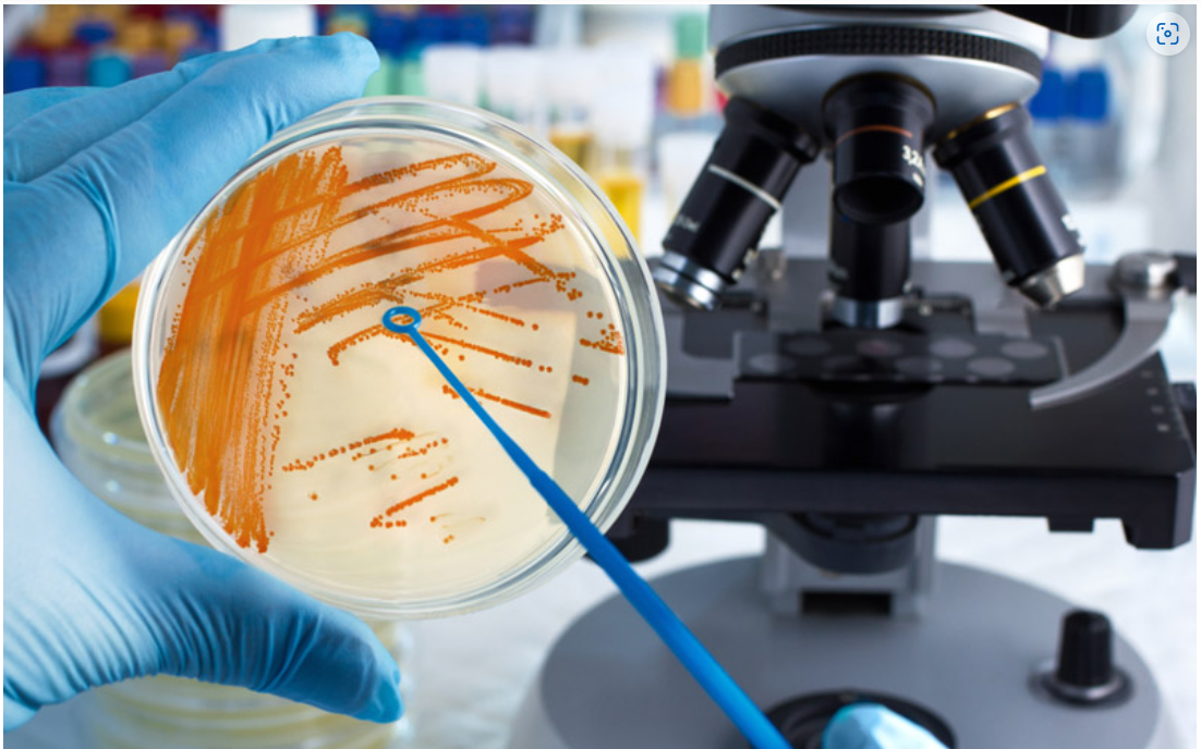 Analysis total plate count in non dairy creamer