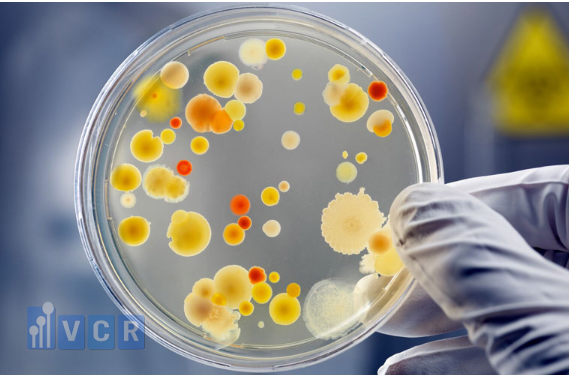 Analysis yeast and mold in non dairy creamer